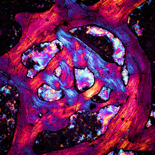 Microscopic Photography - Dinosaur Bone II