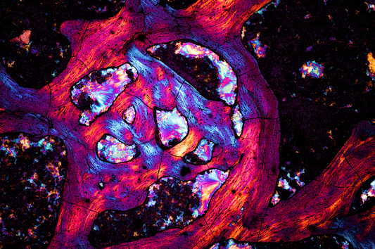 Microscopic Photography - Dinosaur Bone II